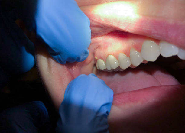 Best Root Canal Emergency Dentist  in Eden, NC